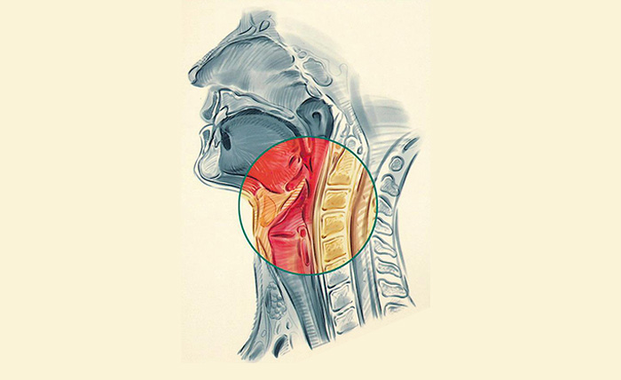 Abast integral del pacient amb disfàgia neurègena. Institut Guttmann